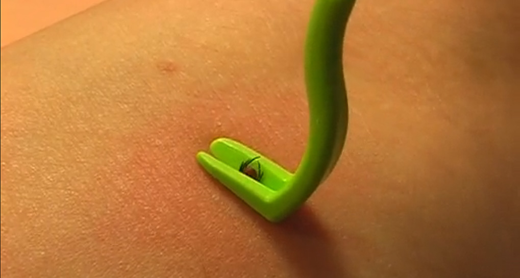 best way to remove a tick from a best way to remove a tick savage cer best way to remove a tick from a best way to remove a tick savage cer